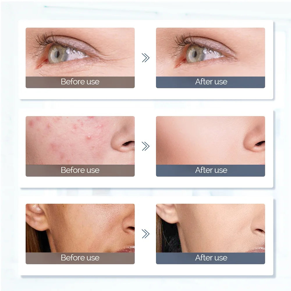 7 Color LED Light Therapy Mask